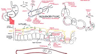 Microbiology  Helicobacter Pylori Ulcer [upl. by Yrekaz]