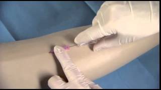 BD Insyte™ Autoguard™ Shielded IV Catheter Insertion Technique [upl. by Evangelina]